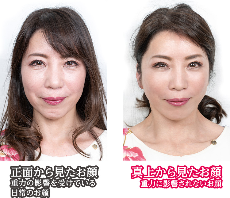 大幅な若見え顔へ